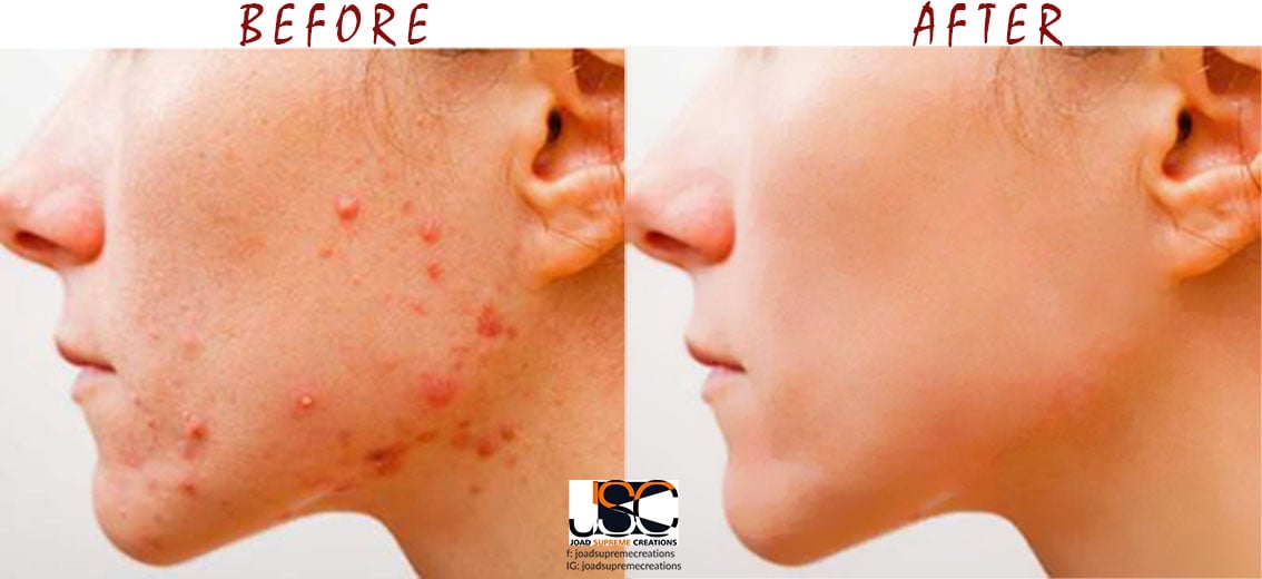 I will remove all the background of your pictures