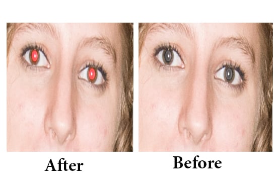 I will do 05 remove red eye or Remove Background