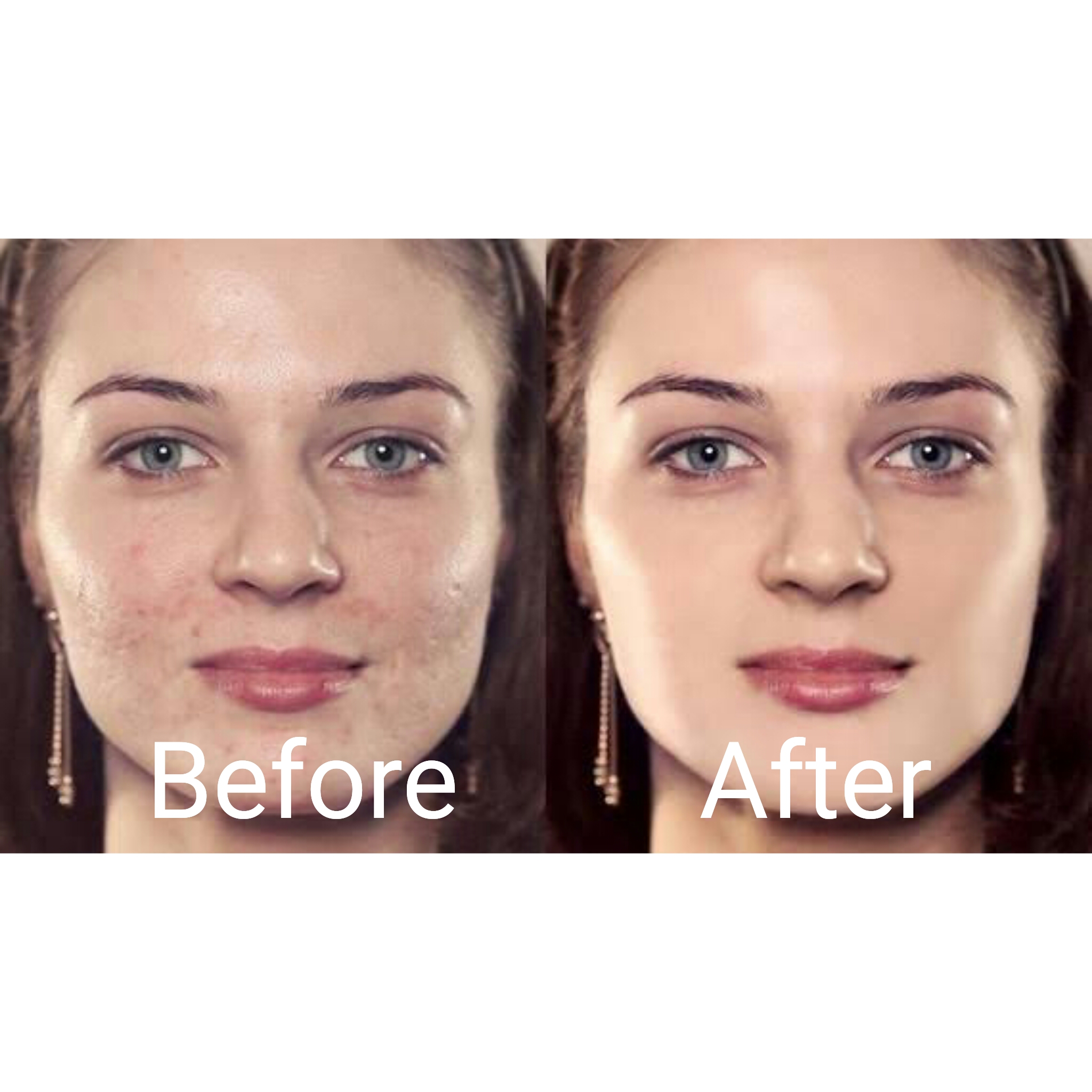 I will do the editing of your photos, photo retouching, skin beautification and deleting background