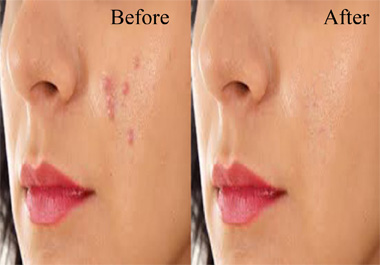 I will do photo editing and skin retouching within 24 hours