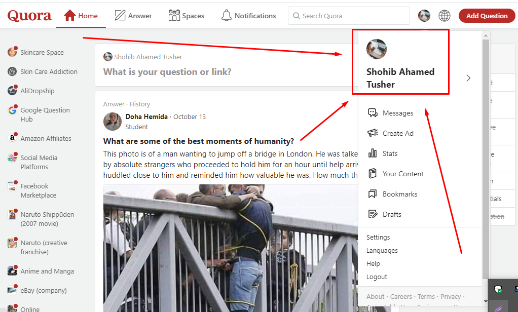 5 High-Quality guaranteed Quora Answers for your website