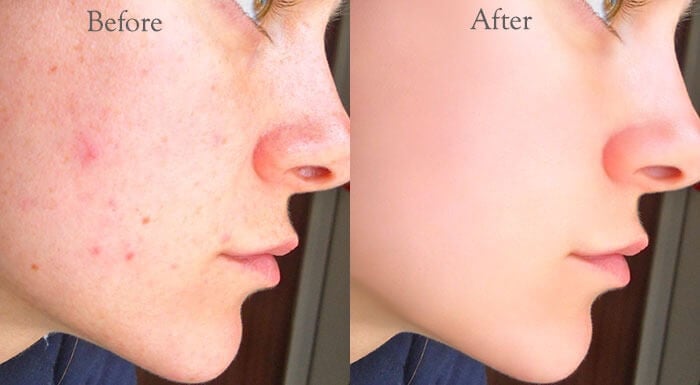 Image retouching with Adobe fast delivery (Certified)