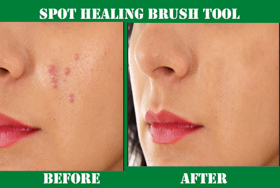 I will remove pimple dark spot and heal face and your background