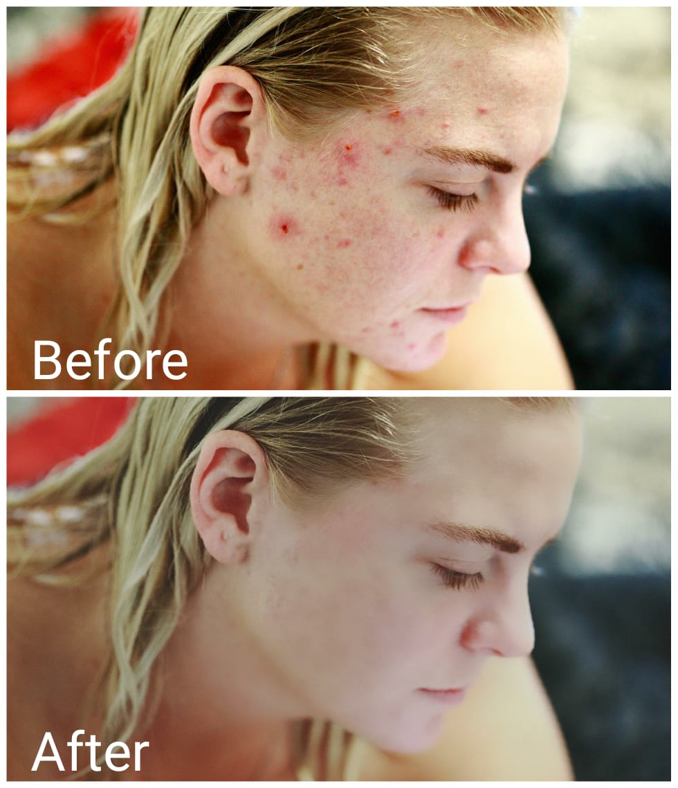 Photo editing, image enhancement and portrait image retouching.