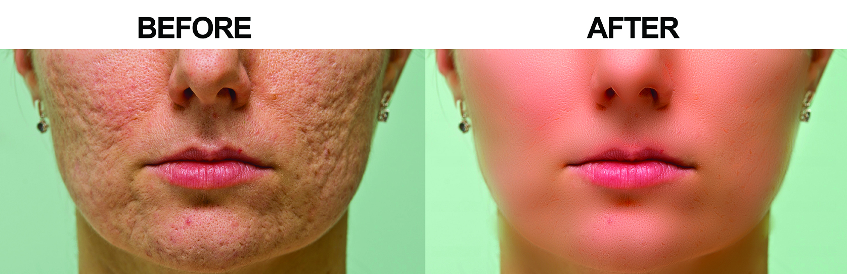 I will do 100 clipping path hair masking only 1 day