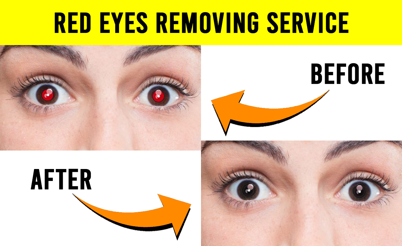 I will remove red eye, red eye removal within 30 minutes