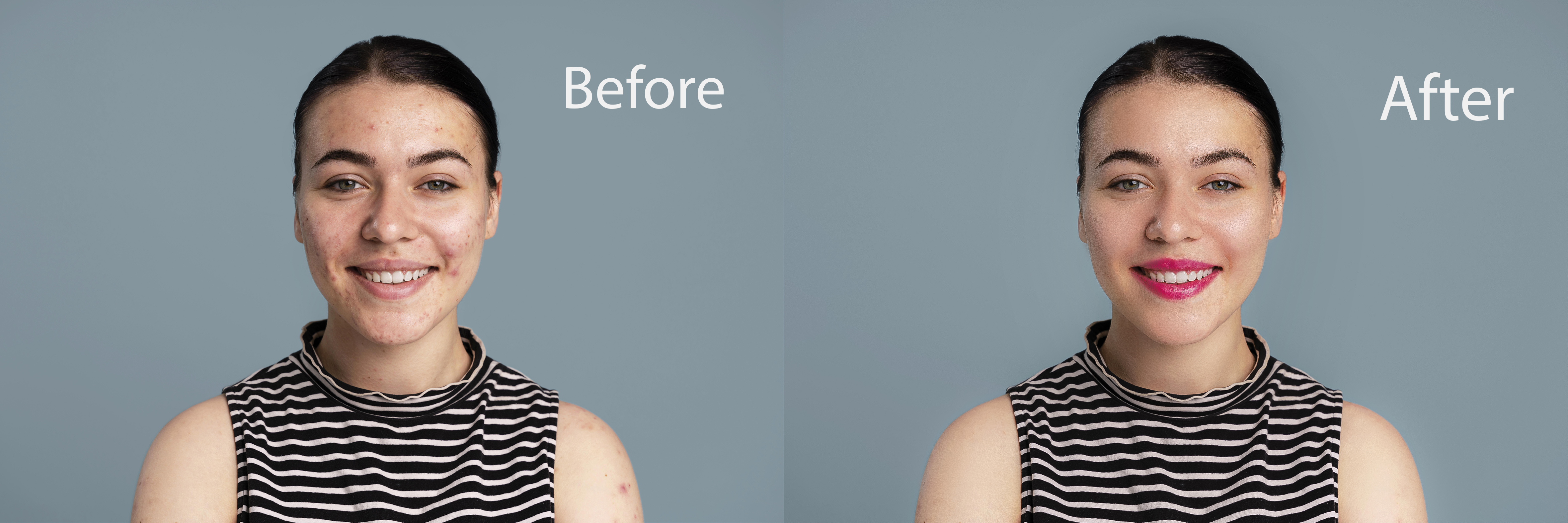 Professional photo retouching acne removal, skin smo...