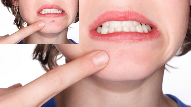 I Will Re-touch Your Photos in Photoshop: Zits, Blemishes and Wrinkles and Color Correct