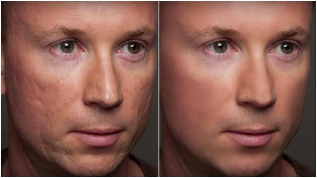 I will remove blemishes and improve skin to three of your photos