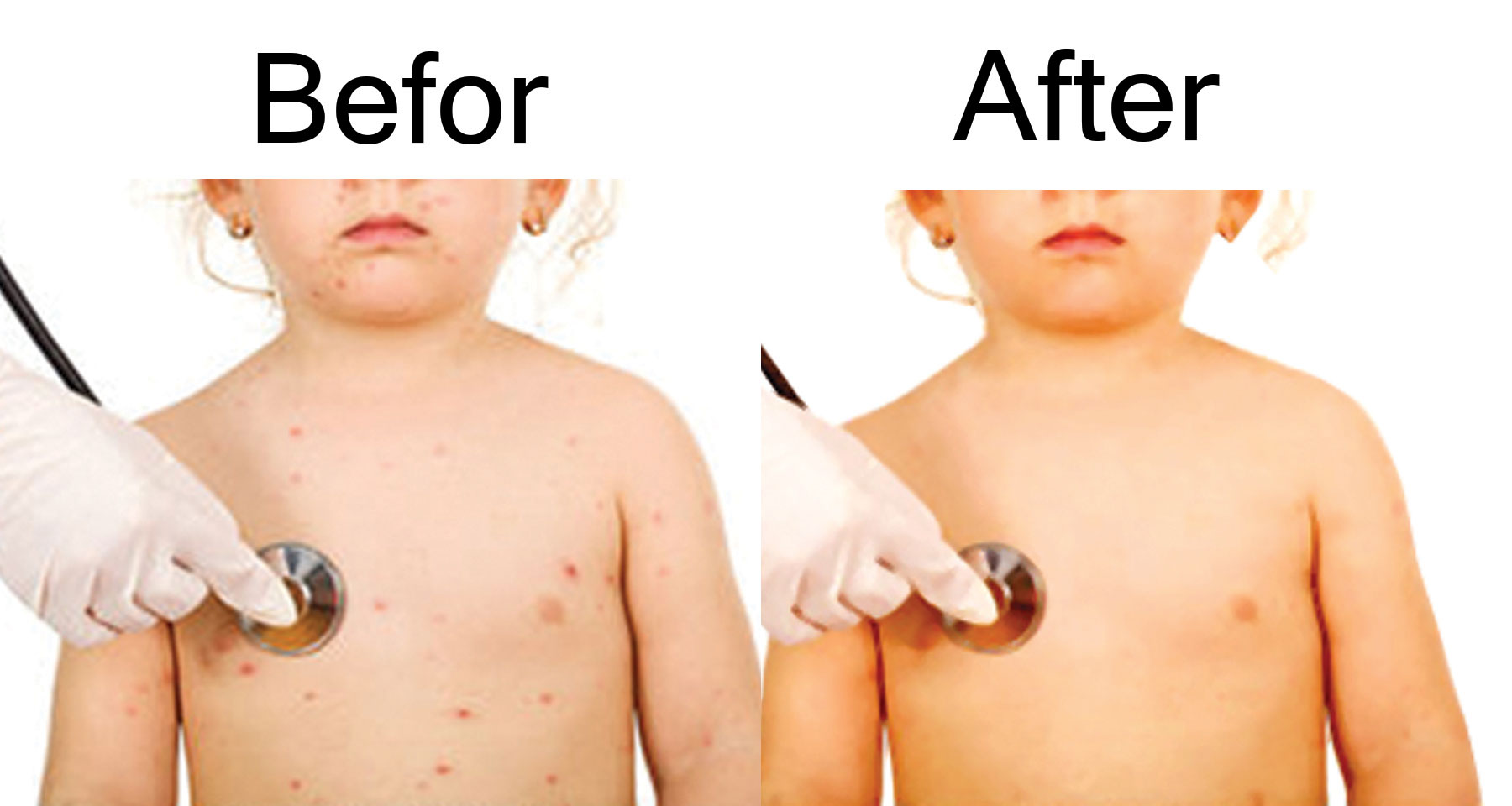 I DO REMOVE 20 IMAGE BACKGROUND AND EDIT PHOTO PIMPLE PROPERLY 24 HOUR