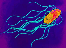 Typhus Symptoms and Treatment
