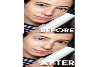 Skin Spots and Defects Gone Forever