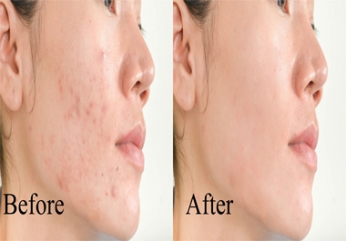 I will do photo editing and skin retouching within 24 hours