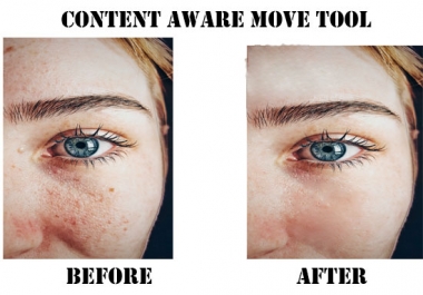 I will remove pimple dark spot and heal face and your background