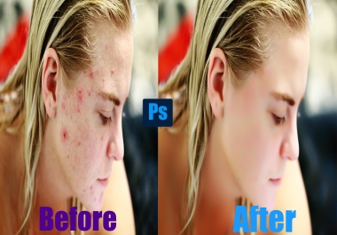 I will do photo editing,  skin retouching,  backgtound removal superfast